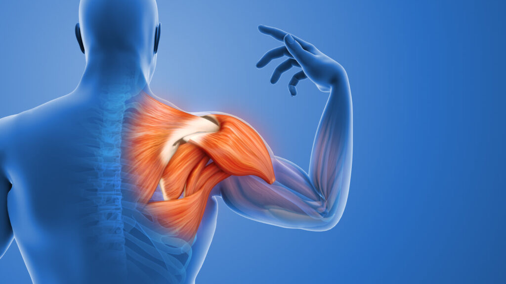 Rotator cuff injury treatment