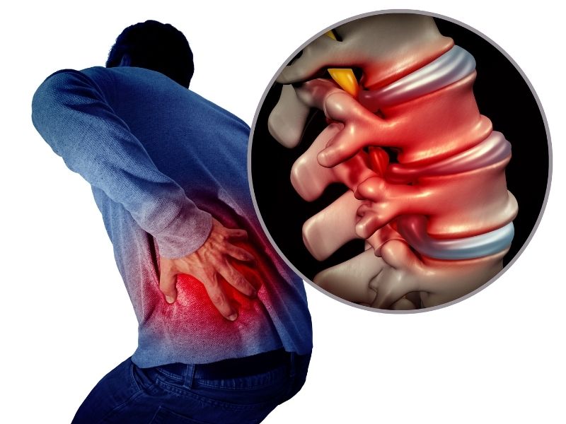 Severe back pain treatment