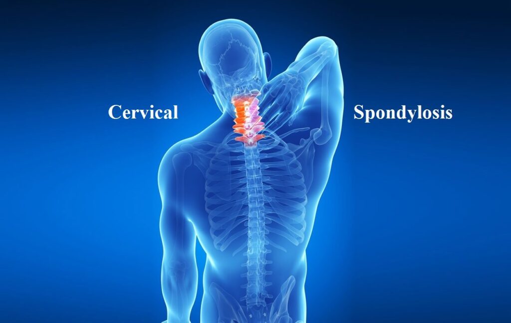 Cervical spondylitis treatment Tilak Nagar