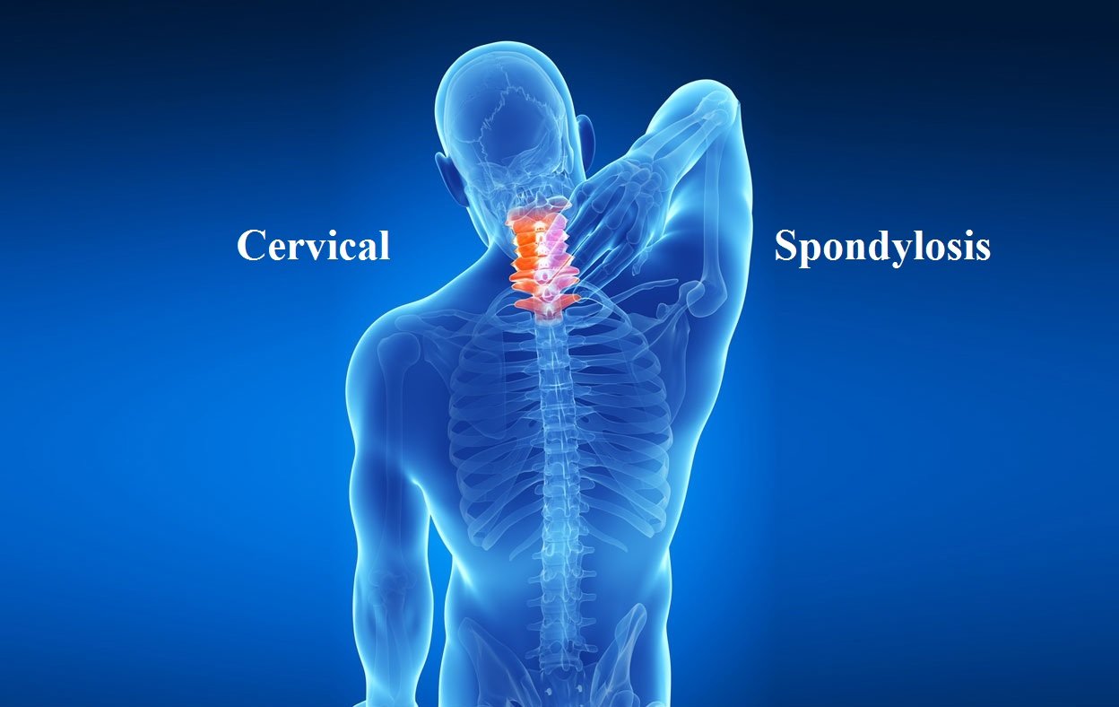 Cervical spondylitis treatment Tilak Nagar