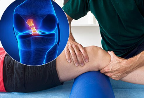 Ligament injury treatment Jaipur Raja Park